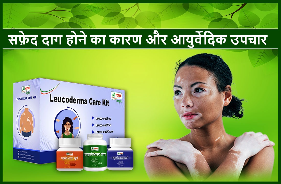 Ayurveda Medicine And Remedy For Vitiligo Treatment