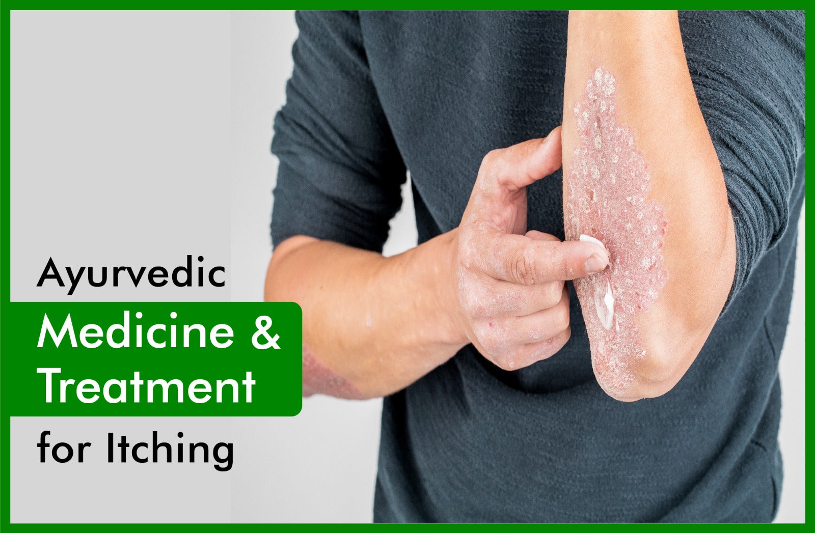 ayurvedic-treatment-and-medicine-for-itching-skin-allergy-rashes