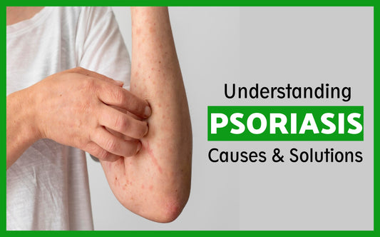 Understanding Psoriasis: Causes and Solutions