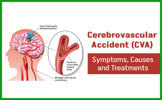 Cerebrovascular Accident (CVA): Causes, Symptoms & Treatment