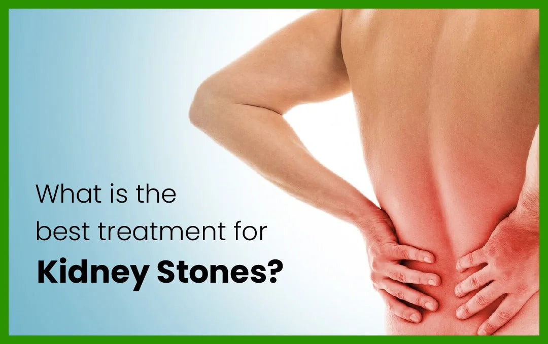 kidney stones treatment,ayurvedic medicine for kidney stone, ayurvedic treatment for kidney stone, kidney stones causes, medicine to break up kidney stones