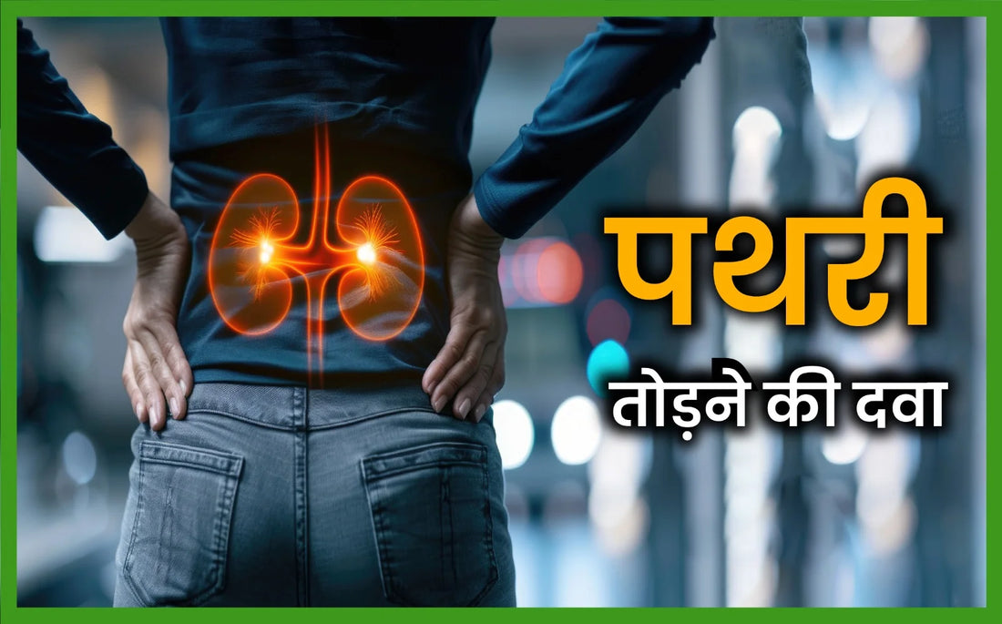 पथरी तोड़ने की दवा, Kidney Stone Tablets, kidney stone medicine name, kidney stone tablet, kidney stone medication, medicine for kidney stone