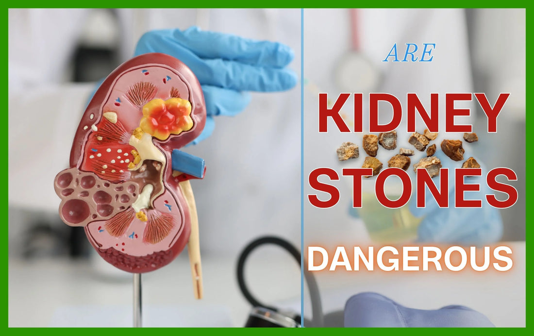 are kidney stones dangerous, causes of kidney stones, is kidney stone dangerous