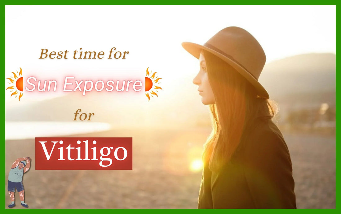 Best time for Sun Exposure for Vitiligo