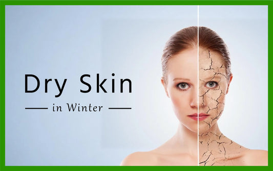 dry skin in winter