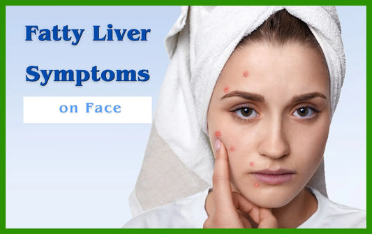 Fatty Liver Symptoms on Face