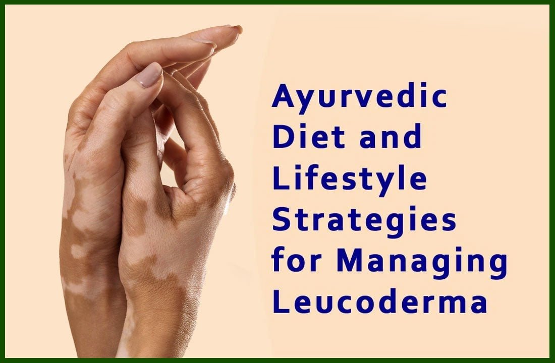 Vitiligo/Leucoderma Treatment In Ayurveda With Proven Results