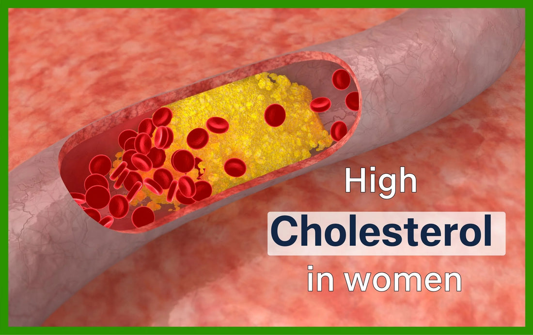 ayurvedic medicine, what causes high cholesterol in women, what increases cholesterol, ayurveda, causes of high cholesterol, best ayurvedic medicine for high cholesterol, best ayurvedic medicine for cholesterol, ayurvedic treatment for cholesterol